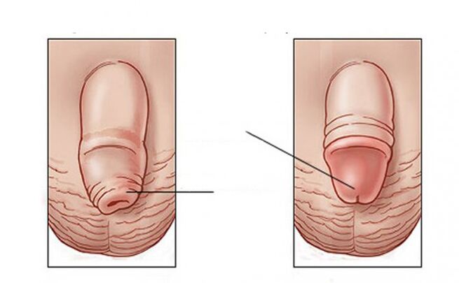 What does lubricant do
